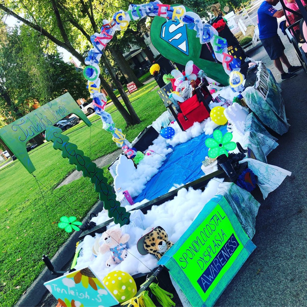 Spondylocostal Dysostosis