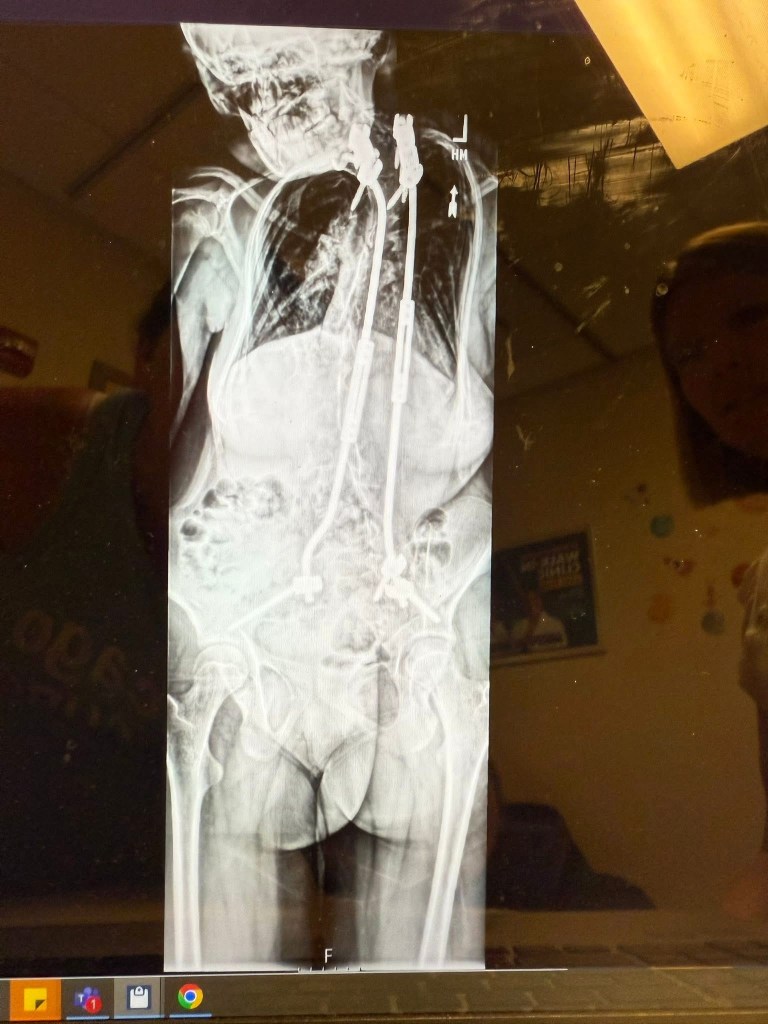 Tenleigh’s most recent x-ray.